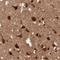 Regulator Of G Protein Signaling 6 antibody, HPA003067, Atlas Antibodies, Immunohistochemistry frozen image 