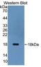 Thymic Stromal Lymphopoietin antibody, abx130469, Abbexa, Western Blot image 