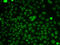 Casein Kinase 2 Alpha 1 antibody, 16-463, ProSci, Immunofluorescence image 