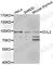 Dishevelled Segment Polarity Protein 2 antibody, A7551, ABclonal Technology, Western Blot image 