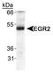 Early Growth Response 2 antibody, TA336535, Origene, Western Blot image 