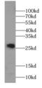 SPANX Family Member A2 antibody, FNab08149, FineTest, Western Blot image 