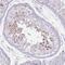 Regulatory Factor X2 antibody, NBP2-13224, Novus Biologicals, Immunohistochemistry paraffin image 