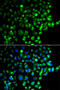 RAB31, Member RAS Oncogene Family antibody, 19-126, ProSci, Immunofluorescence image 