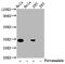 Cyclin Dependent Kinase 2 antibody, CSB-RA005061A15phHU, Cusabio, Western Blot image 