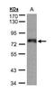 Zinc Finger Protein 7 antibody, GTX103832, GeneTex, Western Blot image 