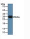 T Cell Immunoreceptor With Ig And ITIM Domains antibody, MBS2028446, MyBioSource, Western Blot image 