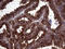 Clathrin Light Chain A antibody, LS-C792142, Lifespan Biosciences, Immunohistochemistry paraffin image 