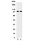 Tight Junction Protein 3 antibody, R31079, NSJ Bioreagents, Western Blot image 