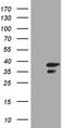 Clathrin light chain A antibody, TA809615, Origene, Western Blot image 