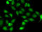 TEA Domain Transcription Factor 1 antibody, 22-472, ProSci, Immunofluorescence image 