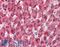 Cytochrome P450 Family 2 Subfamily E Member 1 antibody, LS-B8344, Lifespan Biosciences, Immunohistochemistry paraffin image 