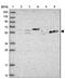 Tektin 1 antibody, NBP1-92487, Novus Biologicals, Western Blot image 