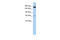 Regulation Of Nuclear Pre-MRNA Domain Containing 2 antibody, ARP55196_P050, Aviva Systems Biology, Western Blot image 