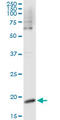 Colony Stimulating Factor 3 antibody, LS-C196982, Lifespan Biosciences, Immunoprecipitation image 