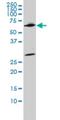 WD Repeat Domain 20 antibody, H00091833-M02, Novus Biologicals, Western Blot image 