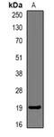 Cathelicidin Antimicrobial Peptide antibody, orb340768, Biorbyt, Western Blot image 