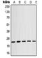 Crystallin Alpha B antibody, LS-C352061, Lifespan Biosciences, Western Blot image 