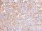 PPFIA Binding Protein 2 antibody, LS-C186257, Lifespan Biosciences, Immunohistochemistry paraffin image 