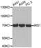 Insulin Receptor Substrate 1 antibody, abx001915, Abbexa, Western Blot image 