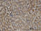 Peroxisomal Biogenesis Factor 11 Beta antibody, LS-C133989, Lifespan Biosciences, Immunohistochemistry paraffin image 