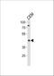 Fatty Acid Desaturase 2 antibody, A01220-1, Boster Biological Technology, Western Blot image 