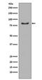 Phosphoinositide-3-Kinase Regulatory Subunit 1 antibody, M00318, Boster Biological Technology, Western Blot image 