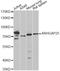 Rho GTPase Activating Protein 25 antibody, A13664, ABclonal Technology, Western Blot image 