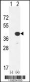 Cathepsin K antibody, 62-867, ProSci, Western Blot image 