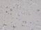Neurofilament Light antibody, M02482-5, Boster Biological Technology, Immunohistochemistry frozen image 