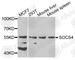 Suppressor Of Cytokine Signaling 4 antibody, A8003, ABclonal Technology, Western Blot image 