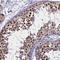 Periphilin 1 antibody, NBP1-89480, Novus Biologicals, Immunohistochemistry frozen image 