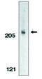 Apoptotic Chromatin Condensation Inducer 1 antibody, MBS396044, MyBioSource, Western Blot image 