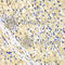 Nucleoporin 62 antibody, A2499, ABclonal Technology, Immunohistochemistry paraffin image 