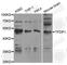 Transcription Factor Dp-1 antibody, A5422, ABclonal Technology, Western Blot image 