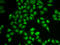 Proteasome Subunit Beta 9 antibody, LS-C331680, Lifespan Biosciences, Immunofluorescence image 
