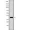 Potassium Calcium-Activated Channel Subfamily M Regulatory Beta Subunit 3 antibody, abx216393, Abbexa, Western Blot image 