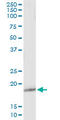 Glutathione Peroxidase 5 antibody, LS-C197344, Lifespan Biosciences, Immunoprecipitation image 