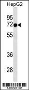 Forkhead Box N3 antibody, 60-414, ProSci, Western Blot image 