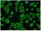 Crystallin Alpha B antibody, NBP2-70454, Novus Biologicals, Immunocytochemistry image 