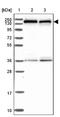 Squamous cell carcinoma antigen recognized by T-cells 3 antibody, NBP2-13281, Novus Biologicals, Western Blot image 