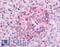 Serum/Glucocorticoid Regulated Kinase 1 antibody, LS-B69, Lifespan Biosciences, Immunohistochemistry paraffin image 