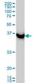 SUMO1 Activating Enzyme Subunit 1 antibody, LS-B6203, Lifespan Biosciences, Western Blot image 