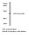 LIM Homeobox Transcription Factor 1 Beta antibody, LS-C177007, Lifespan Biosciences, Western Blot image 