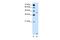 Solute Carrier Family 46 Member 3 antibody, PA5-42530, Invitrogen Antibodies, Western Blot image 