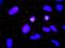 ADAM Metallopeptidase Domain 17 antibody, H00006868-M01, Novus Biologicals, Proximity Ligation Assay image 