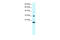 Rho GDP Dissociation Inhibitor Gamma antibody, 27-963, ProSci, Western Blot image 