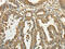 Tubulin Alpha 1c antibody, CSB-PA162779, Cusabio, Immunohistochemistry paraffin image 