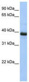 SPO11 Initiator Of Meiotic Double Stranded Breaks antibody, TA334460, Origene, Western Blot image 