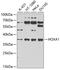 Homeobox A1 antibody, A03416-1, Boster Biological Technology, Western Blot image 